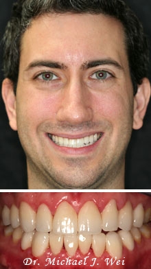dan k after smile makeover