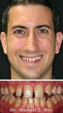 dan k before smile makeover