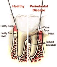 toothdiagram