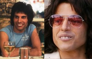 Freddie Mercury teeth rami malek manhattan dds